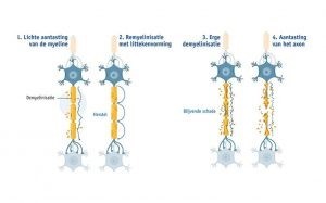 Neuronen Ms